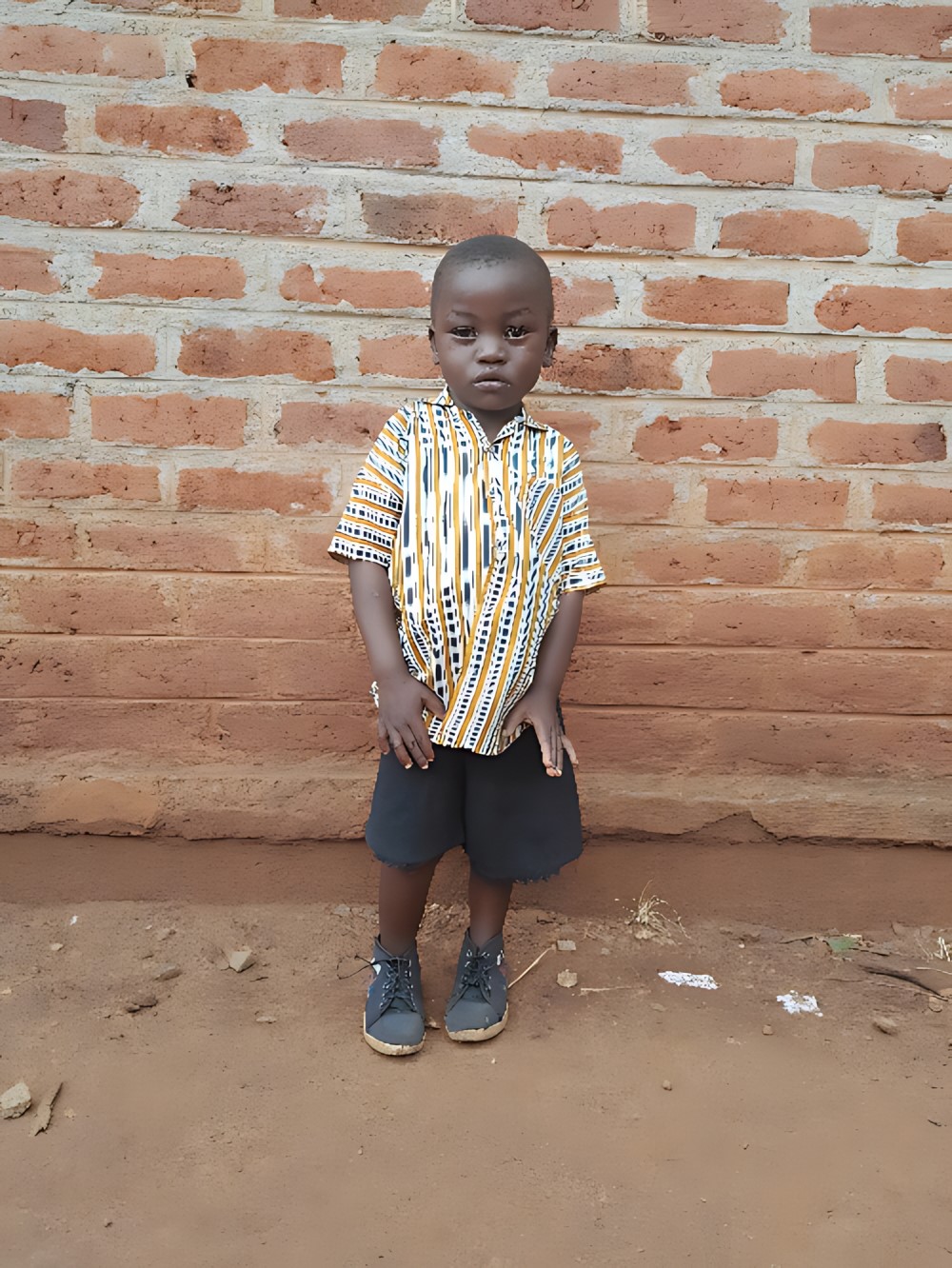 치소모 왕기소니